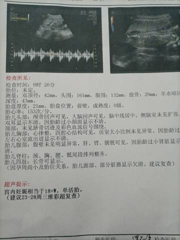 journal_insert_pic_1676882763