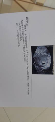 journal_insert_pic_1689502975