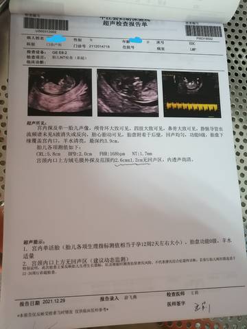 journal_insert_pic_1690026051