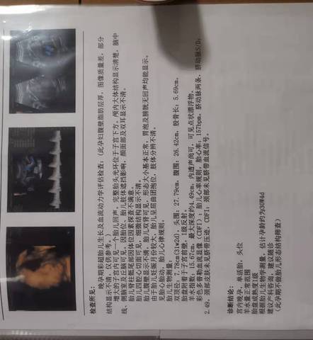 journal_insert_pic_1679198872