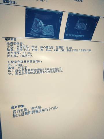journal_insert_pic_1684292116