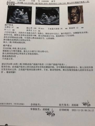 journal_insert_pic_1673952123