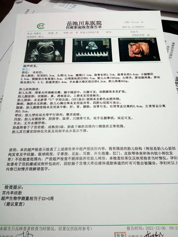 journal_insert_pic_1674743993