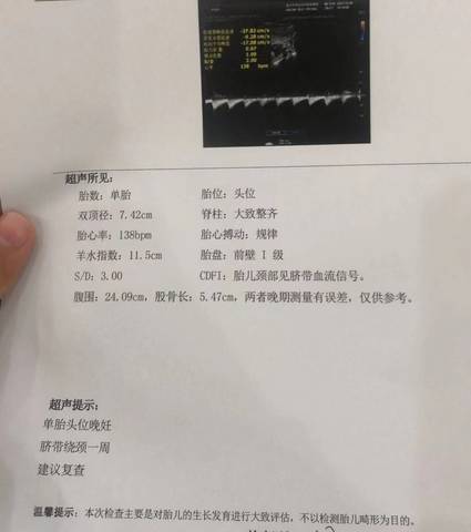 journal_insert_pic_1686483797