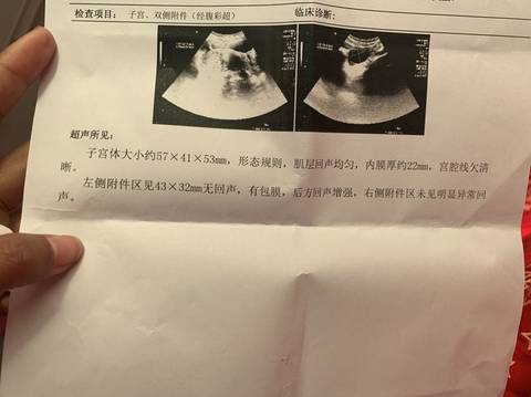 journal_insert_pic_1674182002