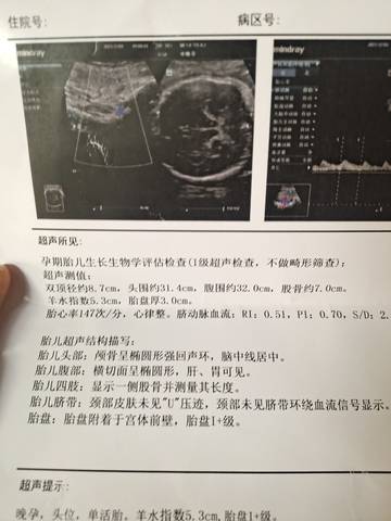 journal_insert_pic_1675360052