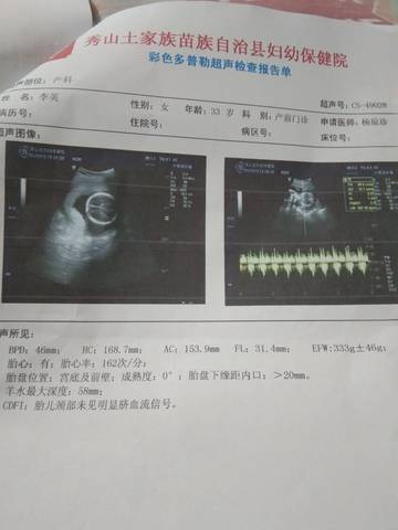 journal_insert_pic_1679207231