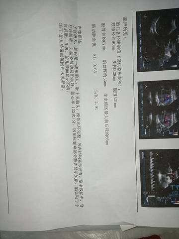 journal_insert_pic_1679324642