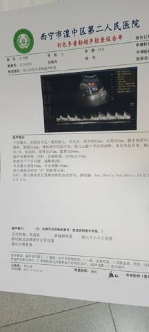 journal_insert_pic_1686091899