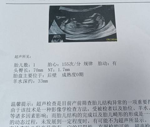 journal_insert_pic_1688364958