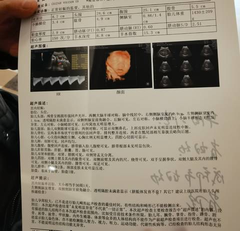 journal_insert_pic_1683751977