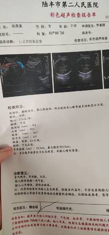 journal_insert_pic_1689650503