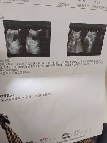 journal_insert_pic_1689590133