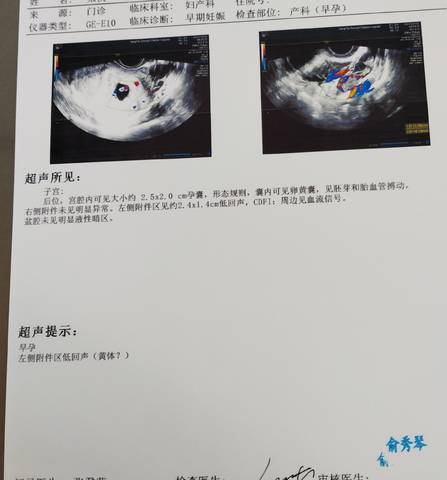 journal_insert_pic_1740857290
