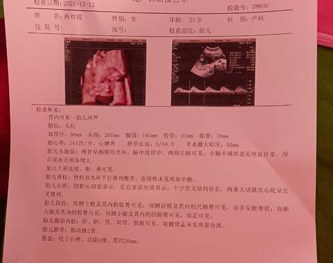 journal_insert_pic_1682642510