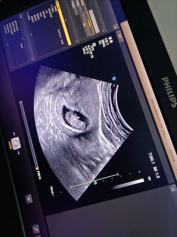 journal_insert_pic_1674434109