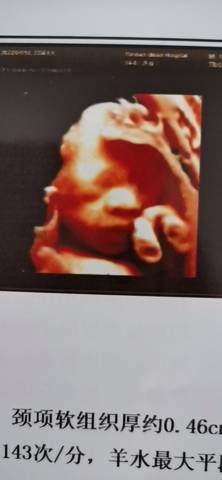 journal_insert_pic_1685638411