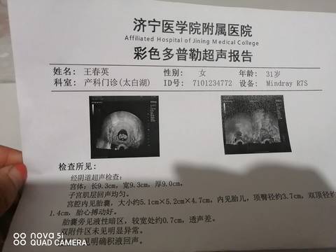journal_insert_pic_1688940321