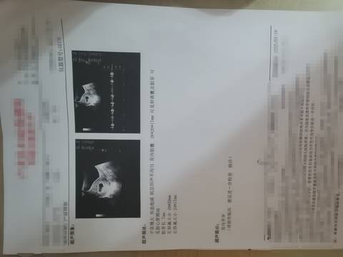 journal_insert_pic_1740980070