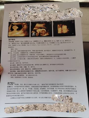 journal_insert_pic_1675408160