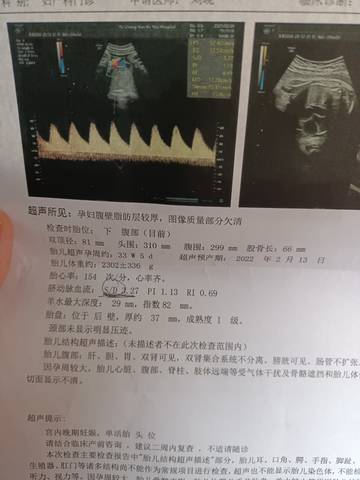 journal_insert_pic_1689578418