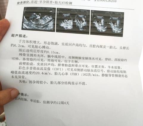 journal_insert_pic_1674830262