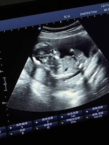 journal_insert_pic_1678140510