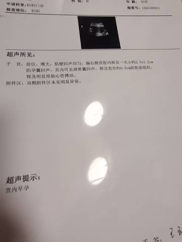 journal_insert_pic_1675152798