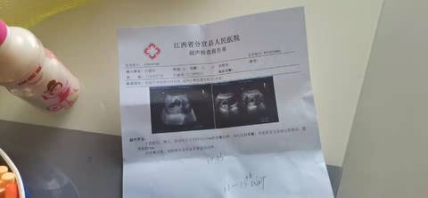 journal_insert_pic_1677522659