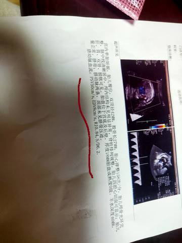 journal_insert_pic_1673152580