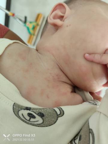 journal_insert_pic_1688917480