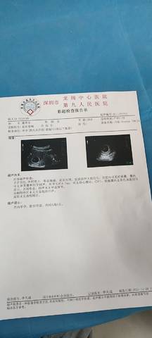 journal_insert_pic_1679523451