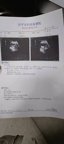 journal_insert_pic_1678164290