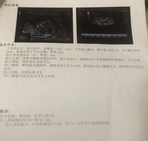 journal_insert_pic_1679308174