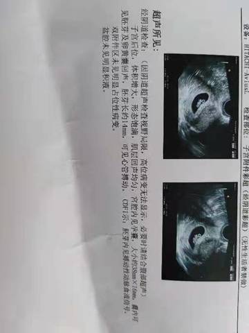 journal_insert_pic_1685024251