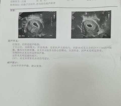 journal_insert_pic_1686558793