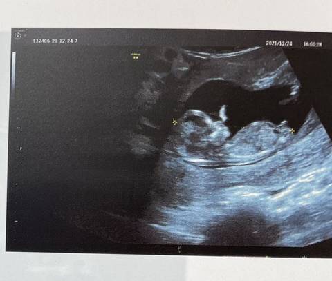 journal_insert_pic_1685652216