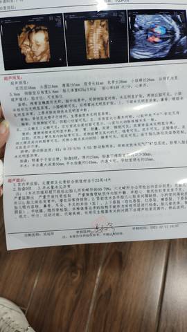 journal_insert_pic_1678022083