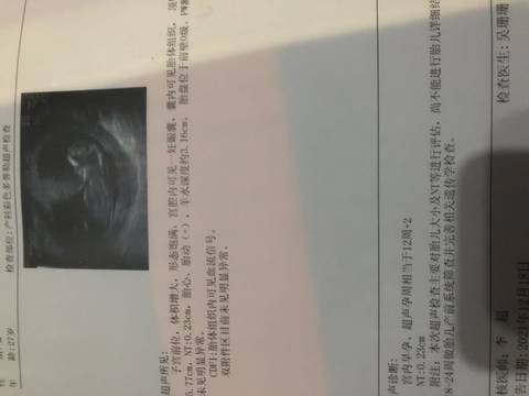 journal_insert_pic_1682074884