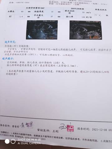 journal_insert_pic_1676866262