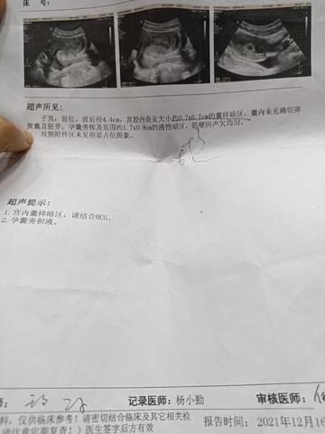 journal_insert_pic_1689553493