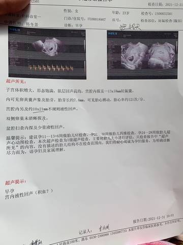 journal_insert_pic_1689433404