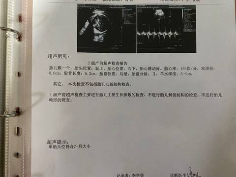 journal_insert_pic_1674135665