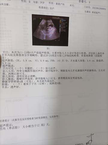 journal_insert_pic_1674599324