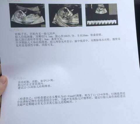 journal_insert_pic_1678497352