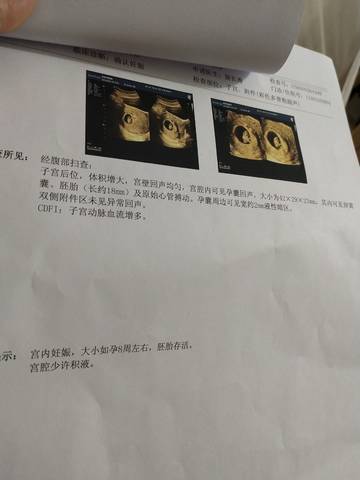 journal_insert_pic_1682095655