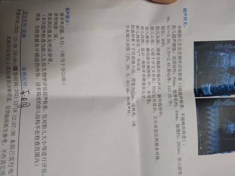 journal_insert_pic_1685984347
