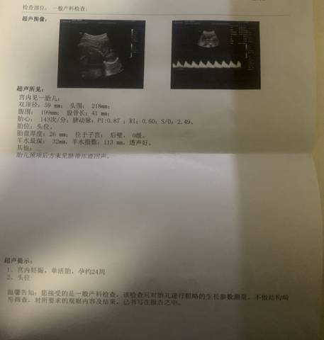 journal_insert_pic_1687921034