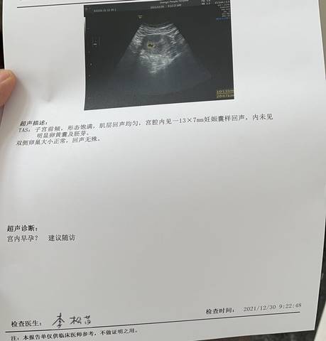 journal_insert_pic_1688808001