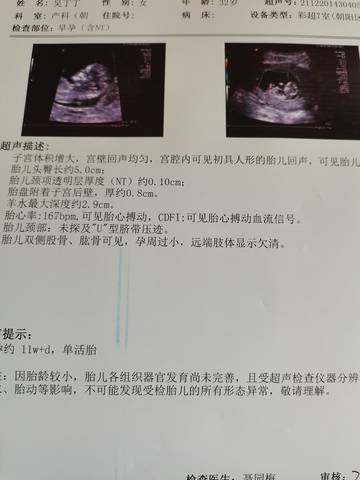 journal_insert_pic_1689832290
